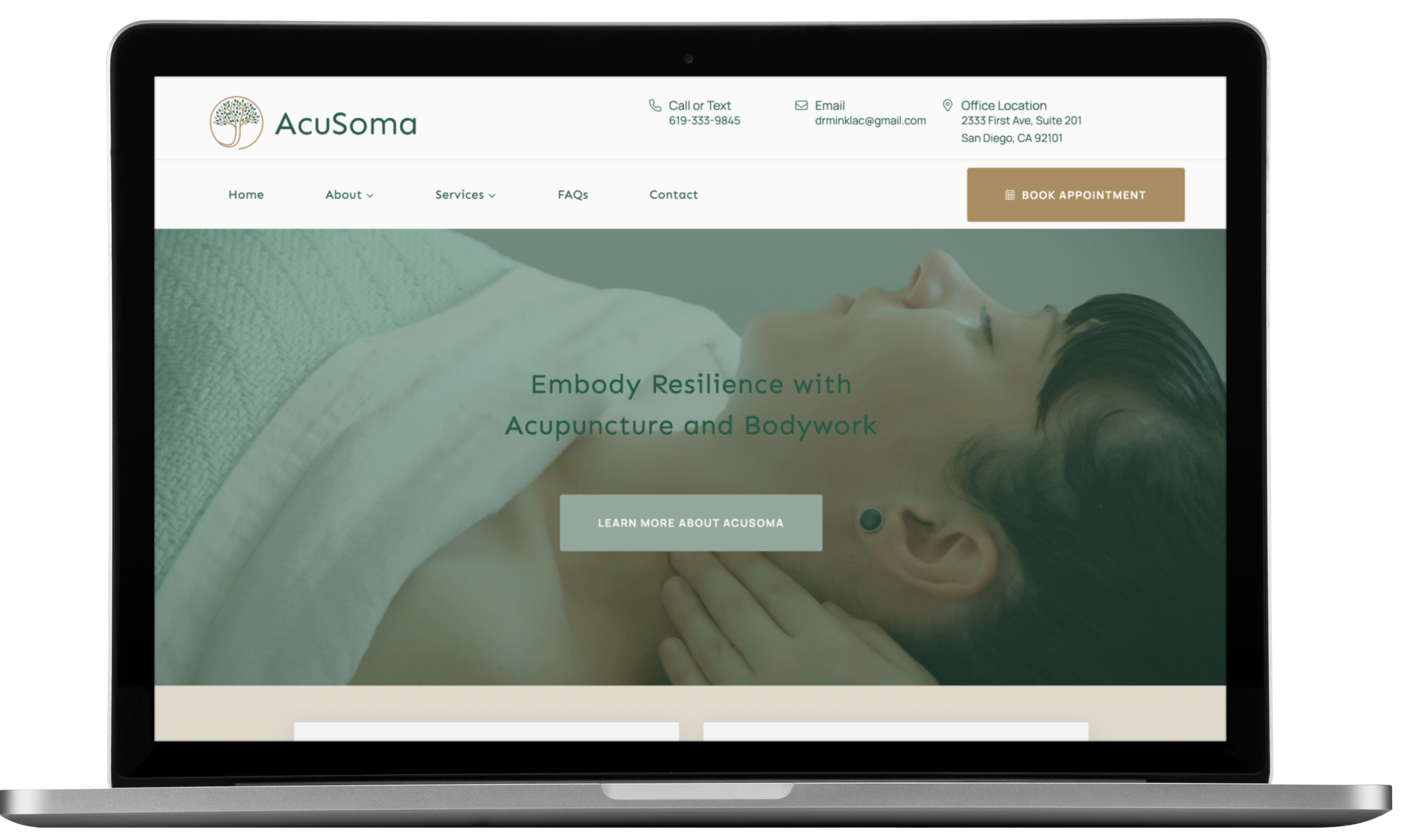 A laptop screen displays the AcuSoma website homepage, featuring a person lying down for acupuncture or bodywork. Showcasing modern website design, text reads, Embody Resilience with Acupuncture and Bodywork at this California wellness practice.